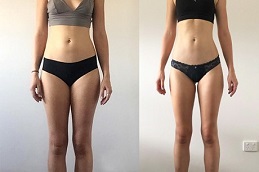 حقن أوزمبيك 7 حقن أوزمبيك في أبوظبي قبل وبعد