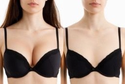 تصغير الثدي 7 تصغير الثدي في أبوظبي قبل وبعد