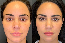 قبل وبعد حشو المعابد في أبو ظبي