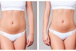 علاجات التخسيس 6 قبل وبعد علاجات التخسيس في أبو ظبي