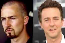 Best-Hair-Implants-in-Abu-Dhabi-Al-Ain