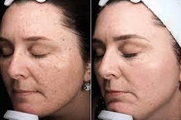 Enlighten Pico Genesis 3 Enlighten-Pico-Genesis-in-Abu-Dhab-Al-Ain