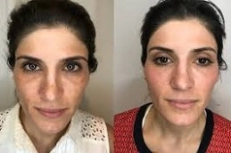 Enlighten Pico Genesis 4 Enlighten-Pico-Genesis-in-Abu-Dhabi