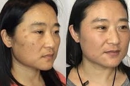 Enlighten Pico Genesis 5 Enlighten-Pico-Genesis