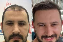 Front line hair fixing in Abu Dhabi & Al Ain