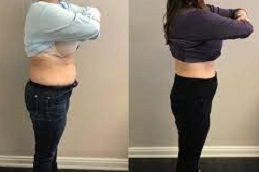 Weight loss Injections 7 Weight loss injections clinic