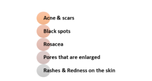 Laser Treatment for Acne Scars Cost in Abu Dhabi 3 bb