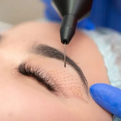 علاج قلم البلازما في أبو ظبي