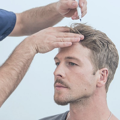 زراعة الشعر بدون ندوب 1 زراعة الشعر بدون ندبات في أبو ظبي والعين الفوائد والتكلفة