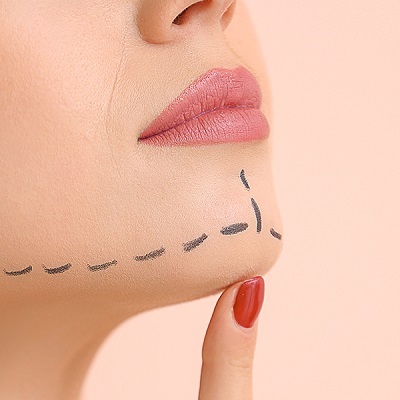 شفط دهون الذقن المزدوج في أبو ظبي