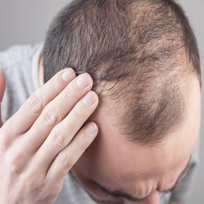 علاج GFC للشعر 1 علاج GFC للشعر في أبو ظبي