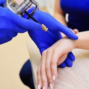 Cryosurgery Cryotherapy in Abu Dhabi Al Ain Cryosurgery Cost