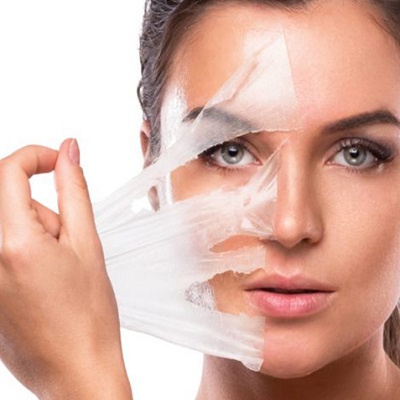 Chemical Peel Facial Packages