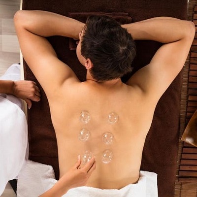 Hijama Treatment in Abu Dhabi Cupping Therapy