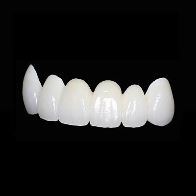 Zirconia Crown Price UAE 999 AED to 1500 AED